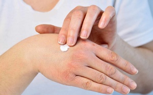 Cách chăm sóc làn da khi bị bệnh vảy nến