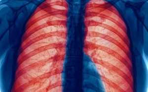  Ăn trái cây và rau xanh giúp giảm nguy cơ mắc bệnh phổi?