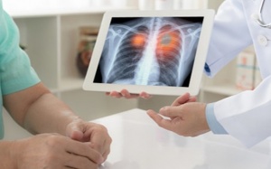 Ung thư phổi có phải do di truyền không, phòng ngừa thế nào?