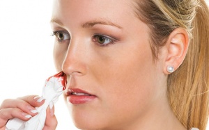 Chảy máu cam trong thai kỳ phải làm thế nào?