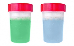 Màu sắc nước tiểu cảnh báo gì về sức khỏe của bạn?