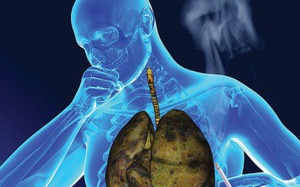 Nên và không nên ăn gì để phòng ngừa ung thư phổi?