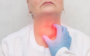Sưng cổ, tim đập nhanh có thể là triệu chứng của cường giáp