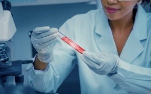 Xét nghiệm di truyền giúp phát hiện đột biến gene ung thư