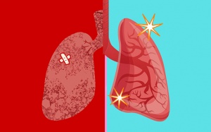 Chất lượng không khí kém: 6 cách đơn giản làm sạch, giải độc phổi