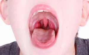 Trẻ viêm họng nên ăn và kiêng ăn uống gì?