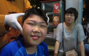 Người bị động kinh ăn gì tốt?