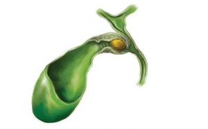 Sỏi kẹt cổ túi mật: Triệu chứng, biến chứng và điều trị thế nào?