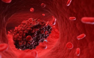 Bật mí 5 loại thực phẩm giúp làm tan cục máu đông