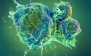 Liệu pháp miễn dịch điều trị ung thư - Dấu ấn hành trình 25 năm của MSD tại Việt Nam