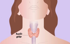 Người bị suy giáp nên có chế độ ăn uống như thế nào?