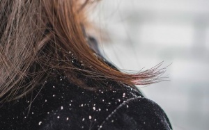 Mách bạn cách đơn giản giúp loại bỏ gàu trong mùa Đông