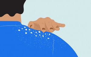 Vảy nến da đầu chữa bằng cách nào?