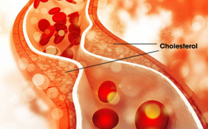 5 vấn đề sức khỏe liên quan đến máu nhiễm mỡ