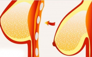 “Bí kíp” khắc phục tình trạng chảy xệ của vòng 1