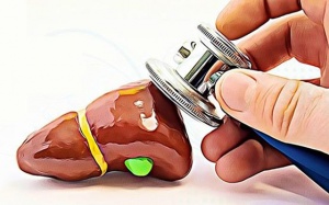 Chi phí mổ sỏi gan là bao nhiêu?