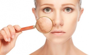 Nguyên nhân khiến làn da bị “tàn phá” vào thời điểm cuối năm