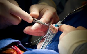 Chăm sóc sau thay van tim thế nào để người bệnh nhanh phục hồi?