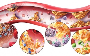 Làm thế nào để kiểm soát mỡ máu an toàn, hiệu quả? 