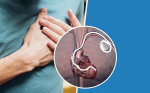 Một vài điều cần biết khi thực hiện liệu pháp tái đồng bộ tim