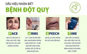 Bạn có biết: Triệu chứng và những cách phục hồi sau tai biến mạch máu não?