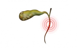 Viêm đường mật: Triệu chứng, biến chứng và cách điều trị thế nào?