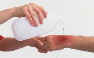 Mẹo trị bỏng nhẹ bằng các phương pháp tự nhiên không để lại sẹo