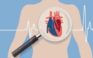 Tổng quan về bệnh tim to, bệnh cơ tim phì đại