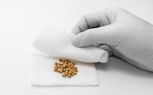 Sỏi mật 7mm nhưng không triệu chứng có nguy hiểm không?