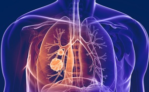 Ung thư phổi di căn nên làm gì để kéo dài thời gian ổn định bệnh?