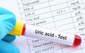 Cách giảm acid uric trong máu bằng sản phẩm thảo dược