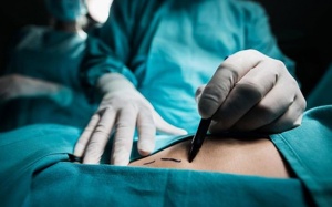 Mổ polyp túi mật có nguy hiểm không, khi nào cần thực hiện?