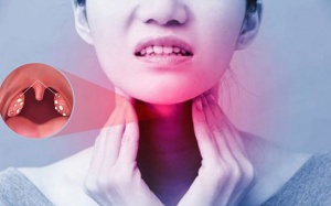 Cải thiện viêm họng mạn tính bằng thảo dược