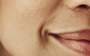 5 lý do không ngờ khiến lỗ chân lông to