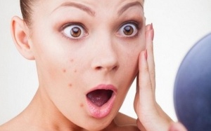 Những khói quen khi trang điểm khiến da ngày càng nhiều mụn