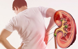 Người bị suy thận độ 2 nên và không nên ăn gì để giảm nguy cơ chạy thận?