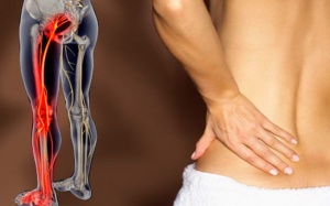 Giải pháp cải thiện đau thần kinh tọa hiệu quả, an toàn từ tự nhiên 