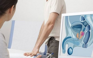 Các yếu tố nguy cơ gây ung thư tuyến tiền liệt