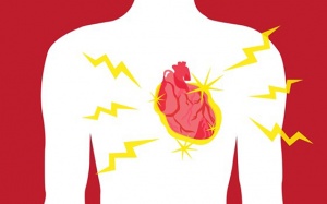 Các biến chứng nguy hiểm của bệnh rung nhĩ