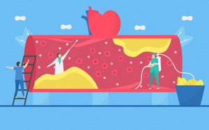 Đề phòng xơ vữa động mạch ở người bệnh tim mạch