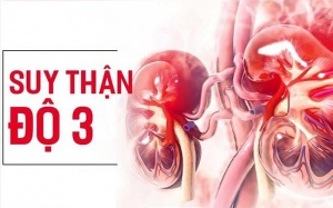 Tại sao người bị suy thận độ 3 nên sử dụng sản phẩm thảo dược?