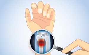 Biện pháp chủ động ngăn ngừa ung thư di căn xương