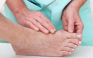 Những dấu hiệu cảnh báo bạn có thể bị bệnh gout