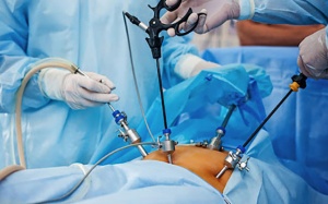 Khi nào nên mổ u nang buồng trứng?