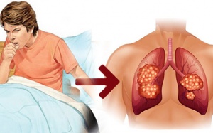 6 dấu hiệu cảnh báo phổi của bạn đang “kêu cứu”