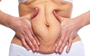 Mẹo giúp khắc phục tình trạng da bụng nhăn nheo, chảy xệ sau sinh