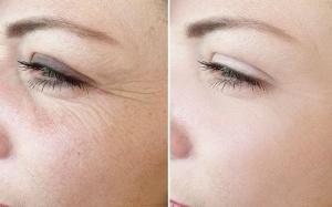 Những tư thế yoga giúp làm săn chắc vùng da quanh mắt 