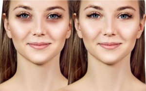 Cải thiện đôi mắt “gấu trúc” bằng những thực phẩm tự nhiên