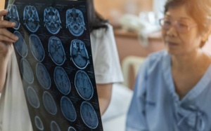 Các phương pháp Tây y điều trị tai biến mạch máu não