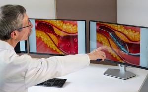 Khi nào cần đặt stent mạch vành, nên làm gì để tránh đặt stent?